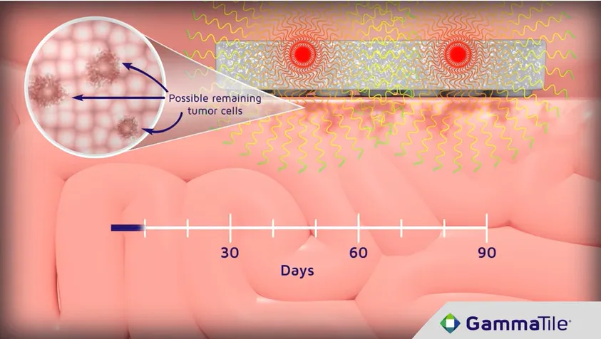  融资2.7亿！医械独角兽完成D轮(图5)