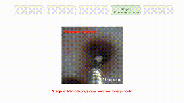 可远程急救！浙大Science子刊发表AI支气管镜机器人，基层福音！(图1)