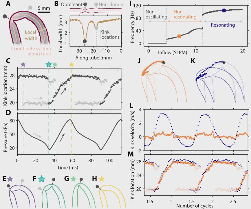 《Science》发表！自振肢体技术赋能软体机器人实现生物级步态(图5)